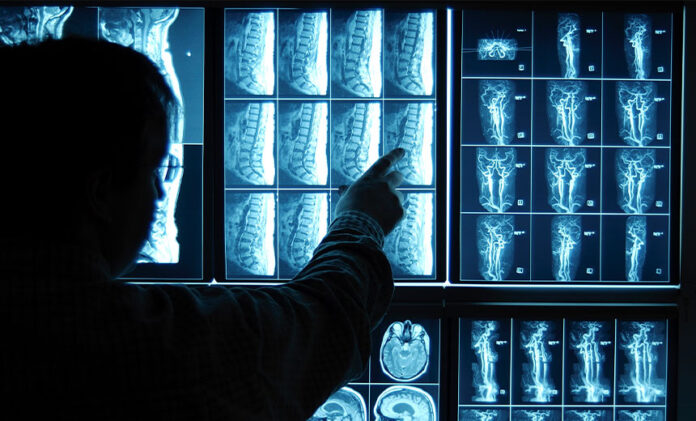 Radiology Practice Hack Affects Sensitive Data of 512,000